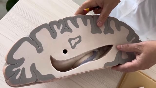 Базальные ядра и белое вещество головного мозга смотреть онлайн