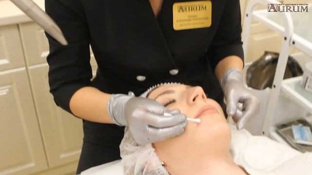 Удаление родинок лазером смотреть онлайн