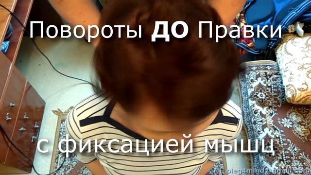 Результаты Правки Атланта - До и После. Наглядное сравнение! Правка в Волгодонске