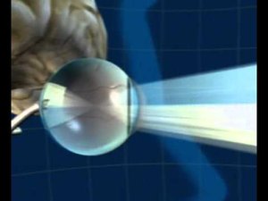 Зрительный анализатор