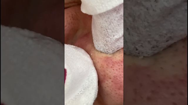 Чистая кожа, придает здоровый вид. Это факт‼️ #увлажнениекожи