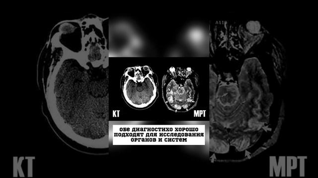 Чем опасны КТ и МРТ?