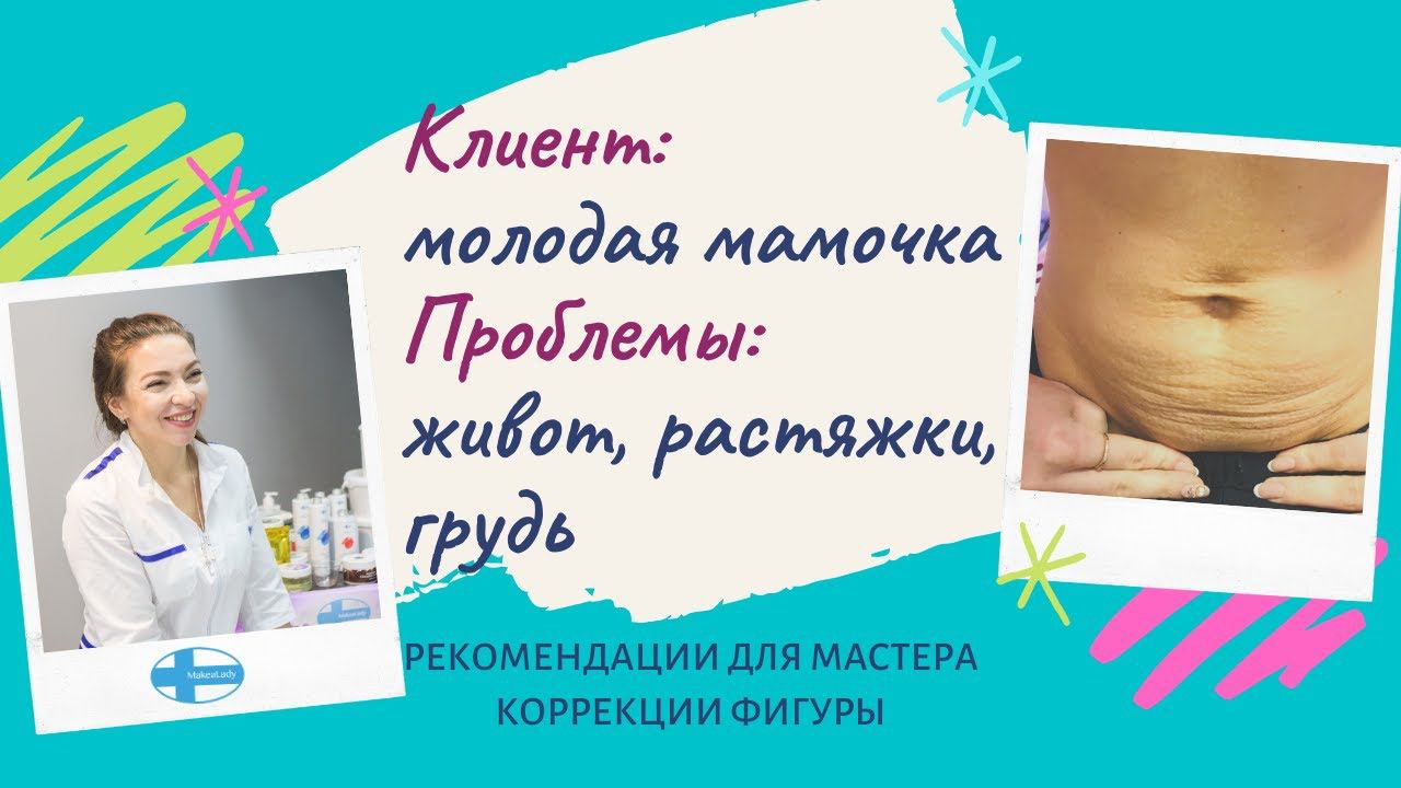 Как убрать живот и растяжки. Как восстановить грудь. Показ результатов До и После