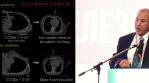 Осложнения лучевой терапии при РМЖ