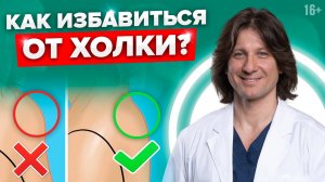 Холка на шее? 3 простых упражнения от холки