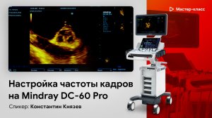 Настройка частоты кадров на примере Mindray DC-60 Pro