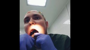 Удаление зуба мудрости самому себе