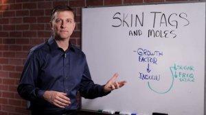 What Causes Skin Tags and Moles? – Dr.Berg