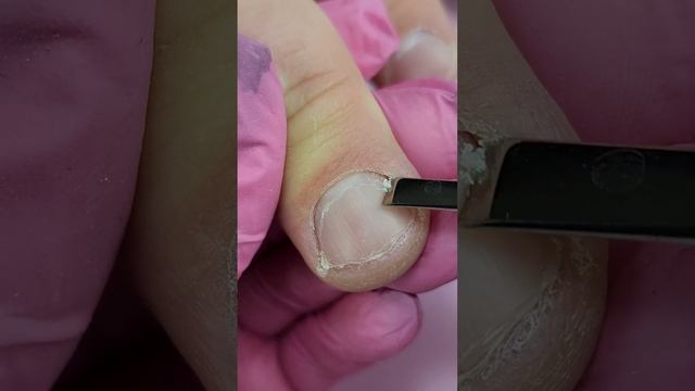 #кутикула #manicure #маникюр #nails #ногти #комби #снятие #комбиманикюр #идеядизайна