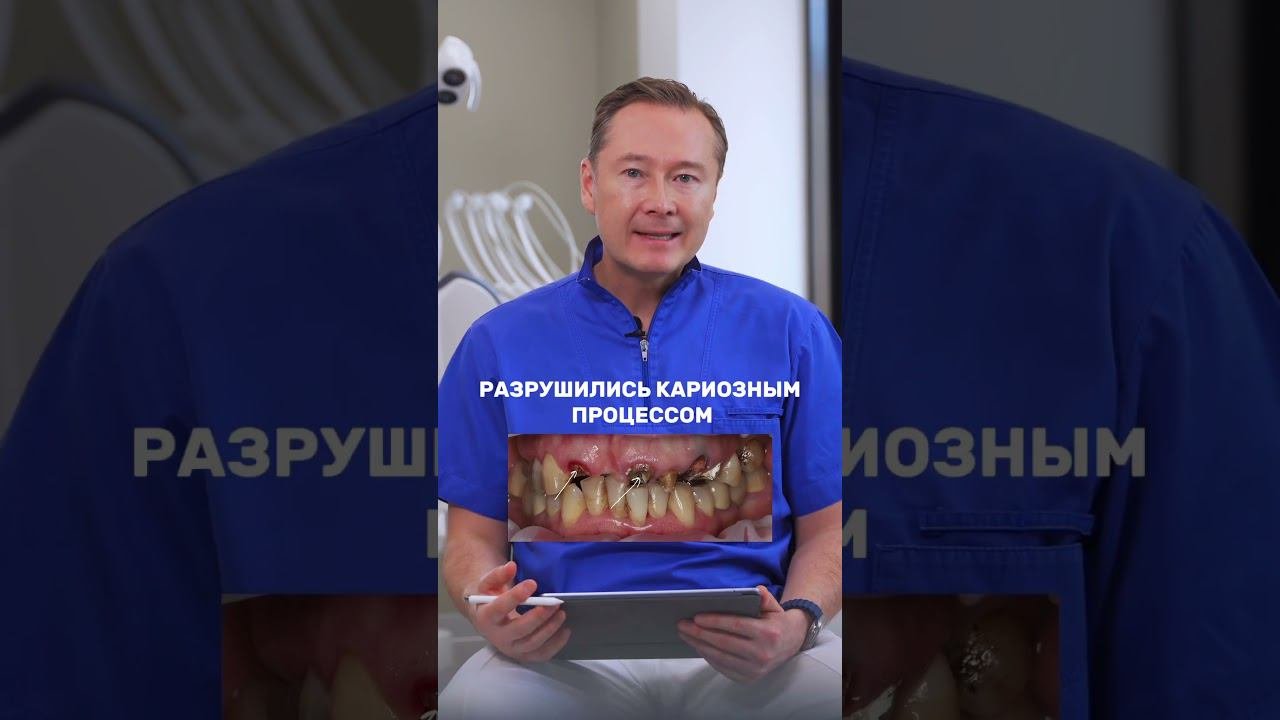 Полное видео у нас на канале #лечениезубов #доктор #стоматологмосква