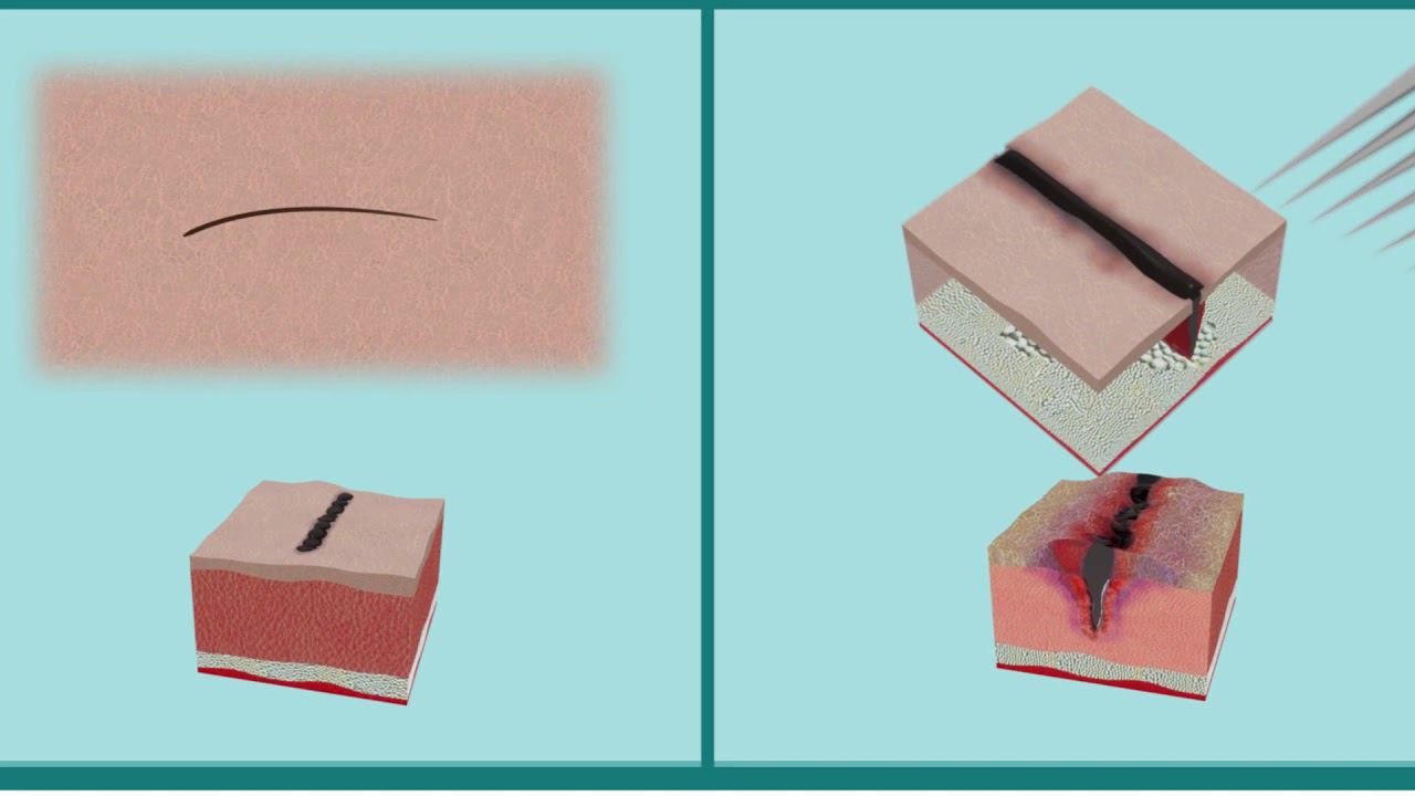 The Truth About #Microblading
