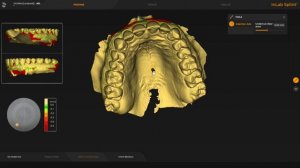 * IDDA MiniBytes - How to design a SPLINT with Inlab 22 with STL's from ANY scanner *