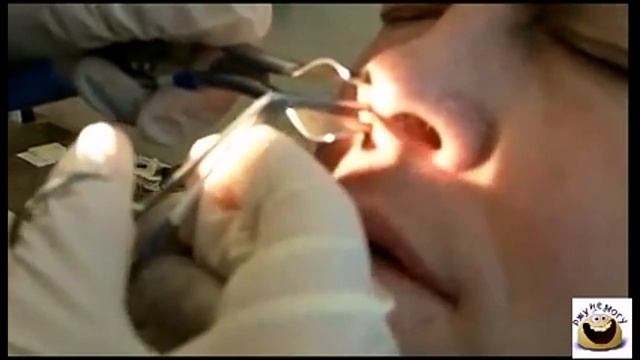 Самая большая в мире КОЗЯВКА смотреть онлайн