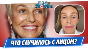 Что случилось с лицом Натальи Андрейченко?