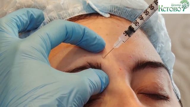 Ботулотоксин смотреть онлайн