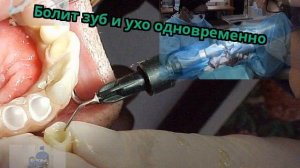 Болит зуб и ухо одновременно