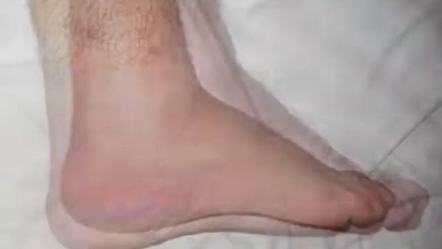Ankle Recovery смотреть онлайн