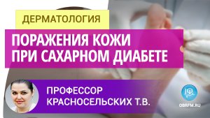 Профессор Красносельских Т.В.: Поражения кожи при сахарном диабете