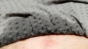 Укус  клеща,  впервый раз в жизни. Ка выглядит клещь.