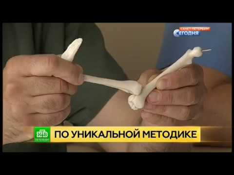 Врожденный вывих голени можно вылечить за 15 минут смотреть онлайн