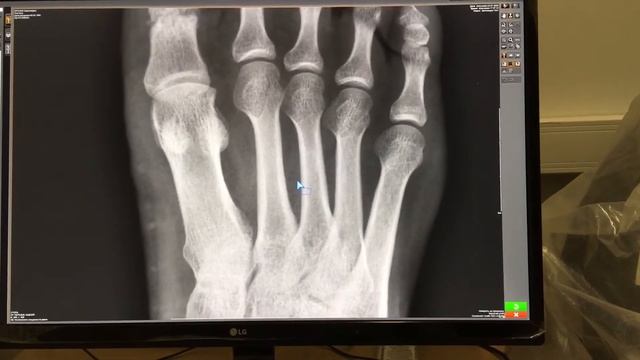 Использование 4К монитора в смотреть онлайн