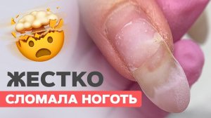 Фатальные ошибки при укреплении | Клюющие ногти