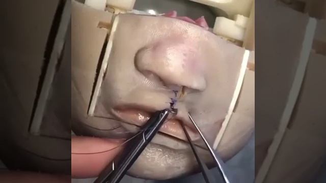 Тренажёр для отработки мануальных навыков смотреть онлайн