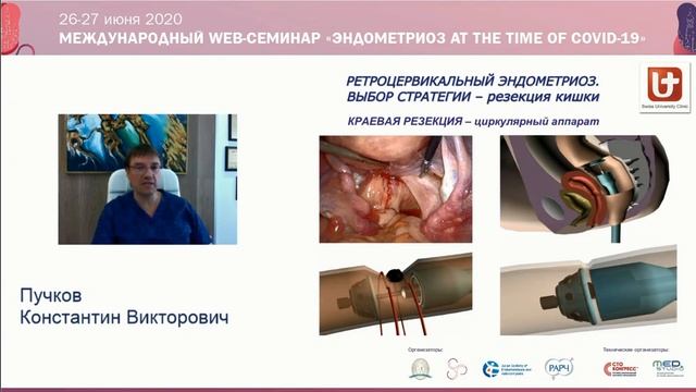 Лекция проф. Пучкова: Хирургическое лечение инфильтративного эндометриоза от А до Я