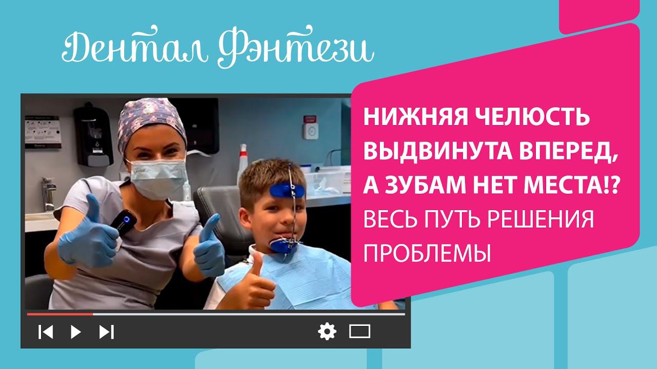 Нижняя челюсть выдвинута вперед, а зубам нет места!? Весь путь решения проблемы