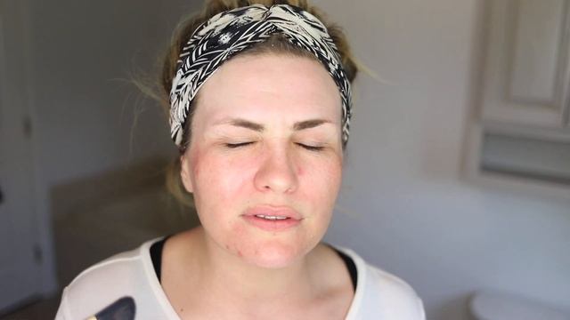 How I Do Chemical Peels |70% Glycolic Peel| смотреть онлайн