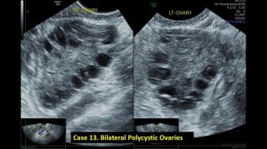 Ultrasound Spotters / Quiz 1 - 25