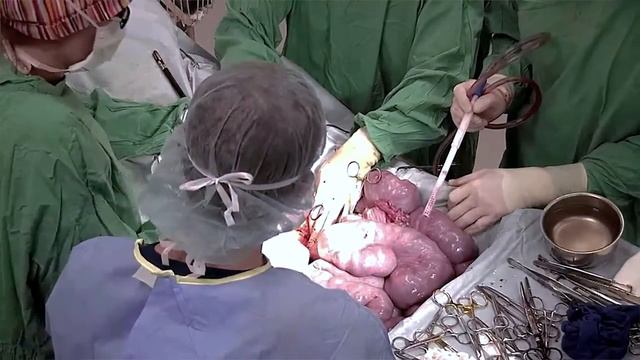 Surgery on Butta the Meishan Pig смотреть онлайн
