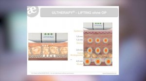 ULTHERAPY® - Straffe Haut mit HiFu Ultraschall im Gesicht, Décolleté und Körper - DR. KATRIN BARTSC