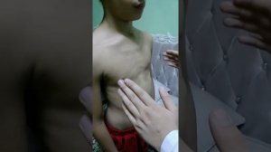 пальпация лимфатических узлов.