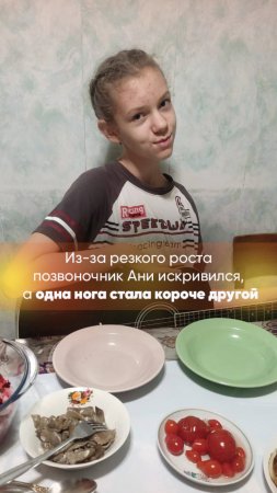 Из-за резкого роста позвоночник Ани искривился, а одна нога стала короче другой