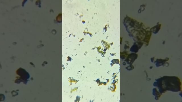 Микромир. Тихоходка, инфузория-туфелька и какие-то червячки в лишайнике на ветке смотреть онлайн