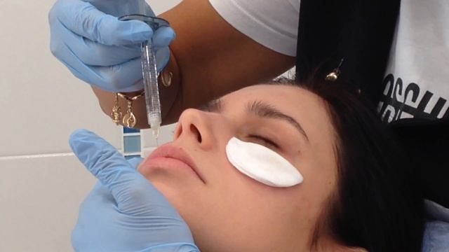 Меди Лайт Контурная пластика заполнение носослезной борозды смотреть онлайн