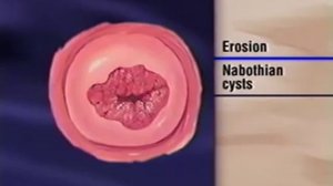 Female Genitalia Examination.wmv