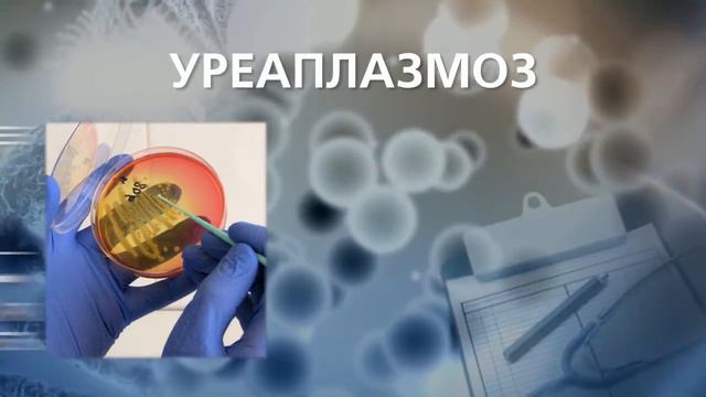 Уреаплазмоз и микоплазмоз
