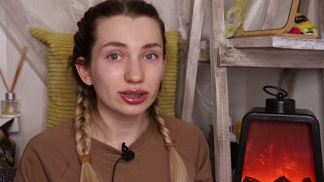 БРЕКЕТЫ: ВЫБОР И СМЕНА ОРТОДОНТА / прикус, кривые зубы, виниры,  врачебная этика. Что дальше?