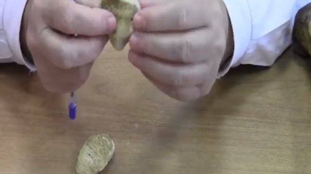 Надколенник