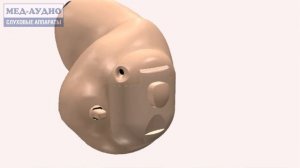 Установка и извлечение батареи внутриушного слухового аппарата