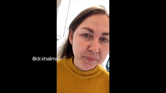 Фуллфейс через МЕСЯЦ смотреть онлайн