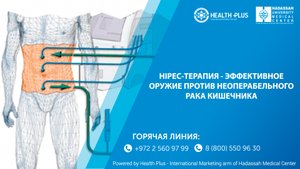 HIPEC-терапия - эффективное оружие против неоперабельного рака. Клиника Хадасса.