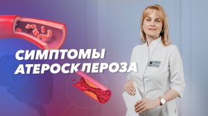 Атеросклероз: причины, симптомы, стадии. Диагностика атеросклероза