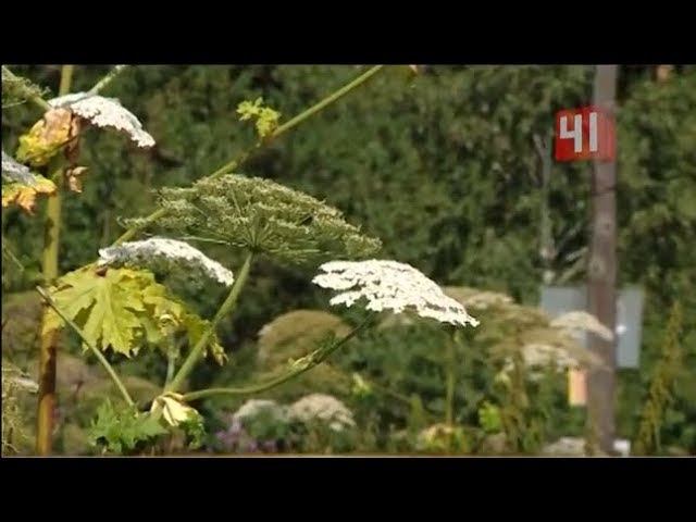 Ожоги от борщевика