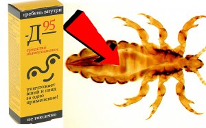 Как избавиться от вшей быстро.