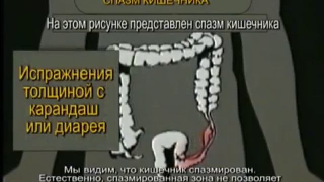 Это должен знать каждый! Очищение организма. Пять систем выделения.