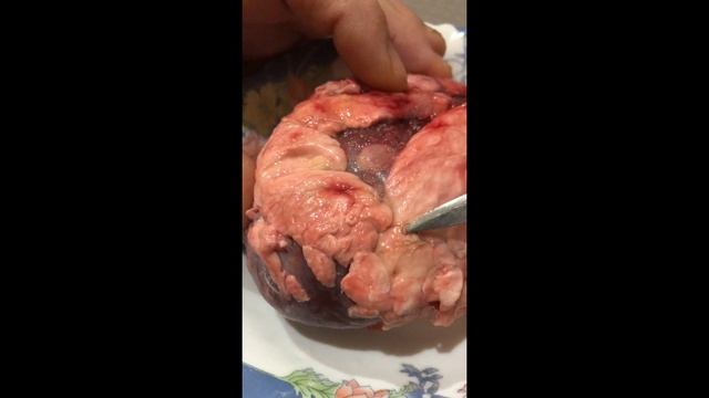Осторожно финноз (бычий цепень) паразиты у лося в мясе и сердце. // Parasites in the moose.