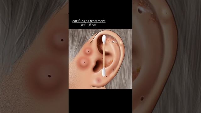 asmr funges treatment #shorts #viral #asmr #asmranimation #shortfeed